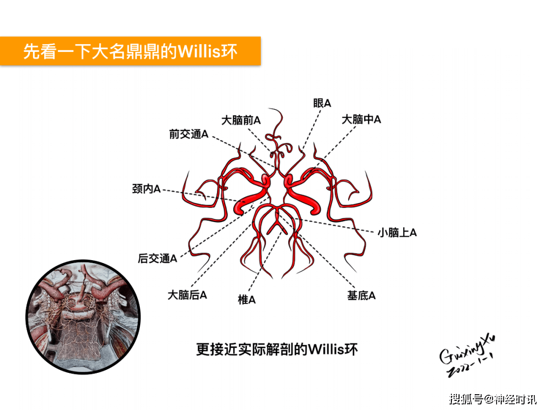 徐桂兴|颅脑解剖手绘(最新作品)_临床_垂体_willis