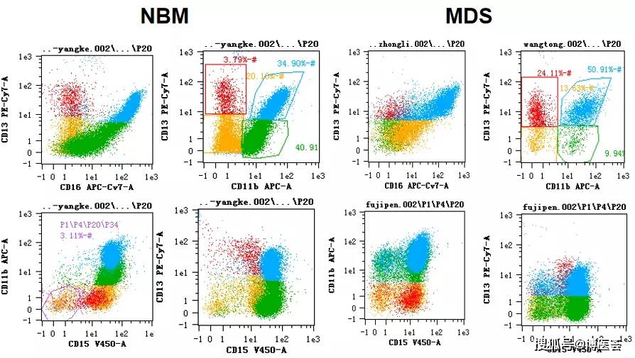 免疫分型在MDS/MPN诊断中的作用有哪些？刘艳荣教授带你一一破解_粒细胞_Ogata_标准