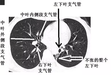 分支_什麼_平臺