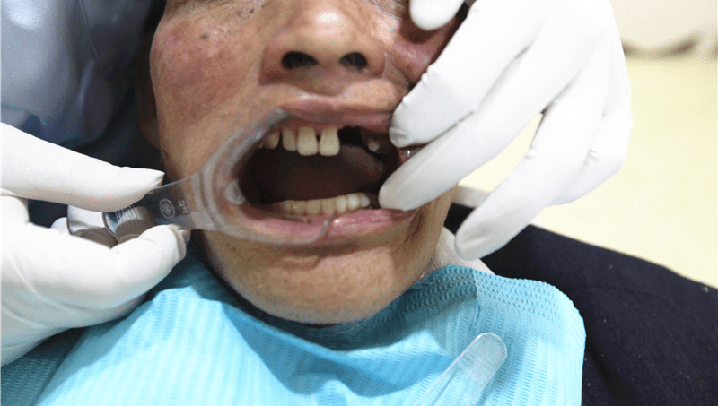 炎症|全民爱牙行动 促进全民口腔健康