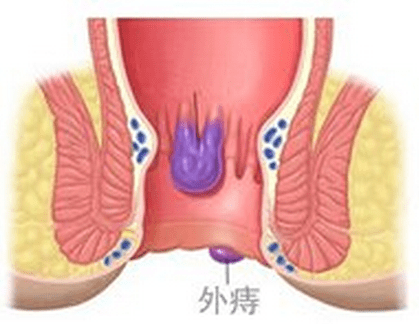 bcb7776d85224d46b9712b0e08dc0f2c.png