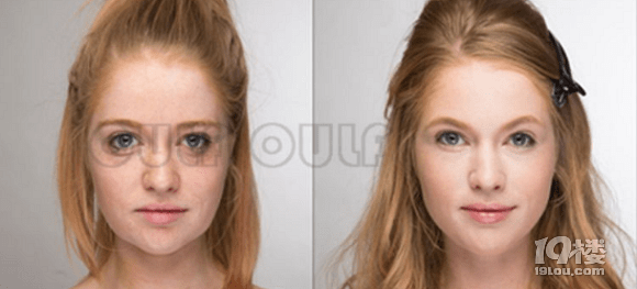 能量热玛吉多大年龄做合适?先看看第五代热玛吉的功效和作用~