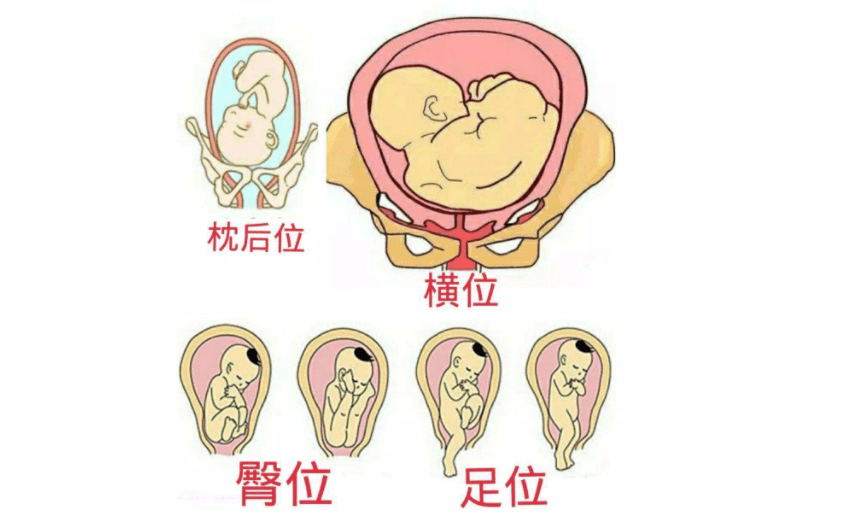 31周宝宝头位姿势图片图片