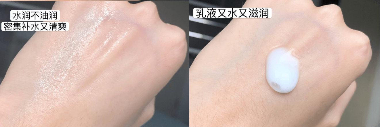 易致敏水乳黑名单吐槽：悦诗风吟易致敏，兰蔻粉水长闭口，孕妈还在囤？