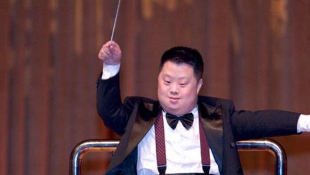 什么叫做唐氏儿 0f667eb1dc214114b5f143e1b792e8b7.jpeg