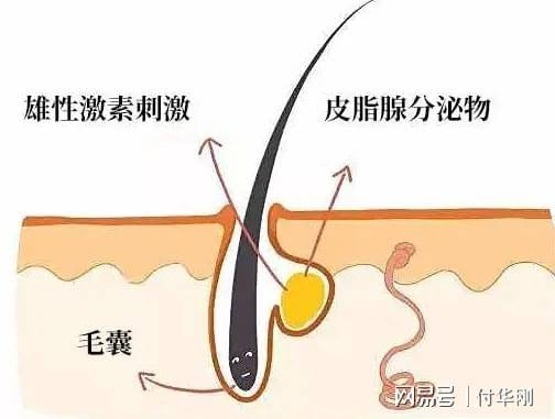 拯救发际线这三步最重要