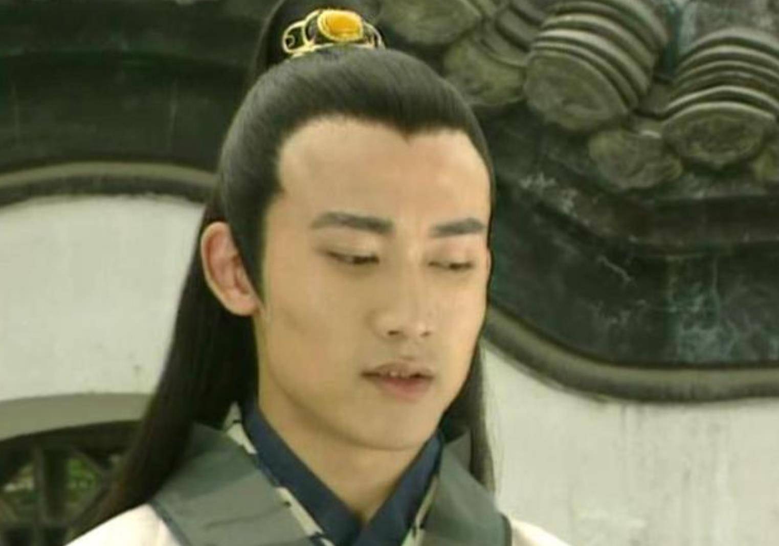 下巴明星频翻车医美需谨慎!有人脸变充气气球,有人下巴变天气预报