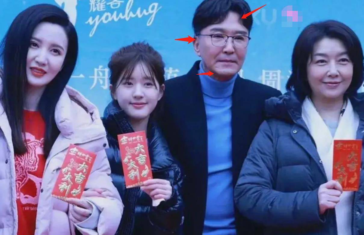 下巴明星频翻车医美需谨慎！有人脸变充气气球，有人下巴变天气预报