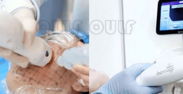 玛吉热玛吉适合多大年龄的人做、热玛吉两年后皮肤会更松弛吗、担心~