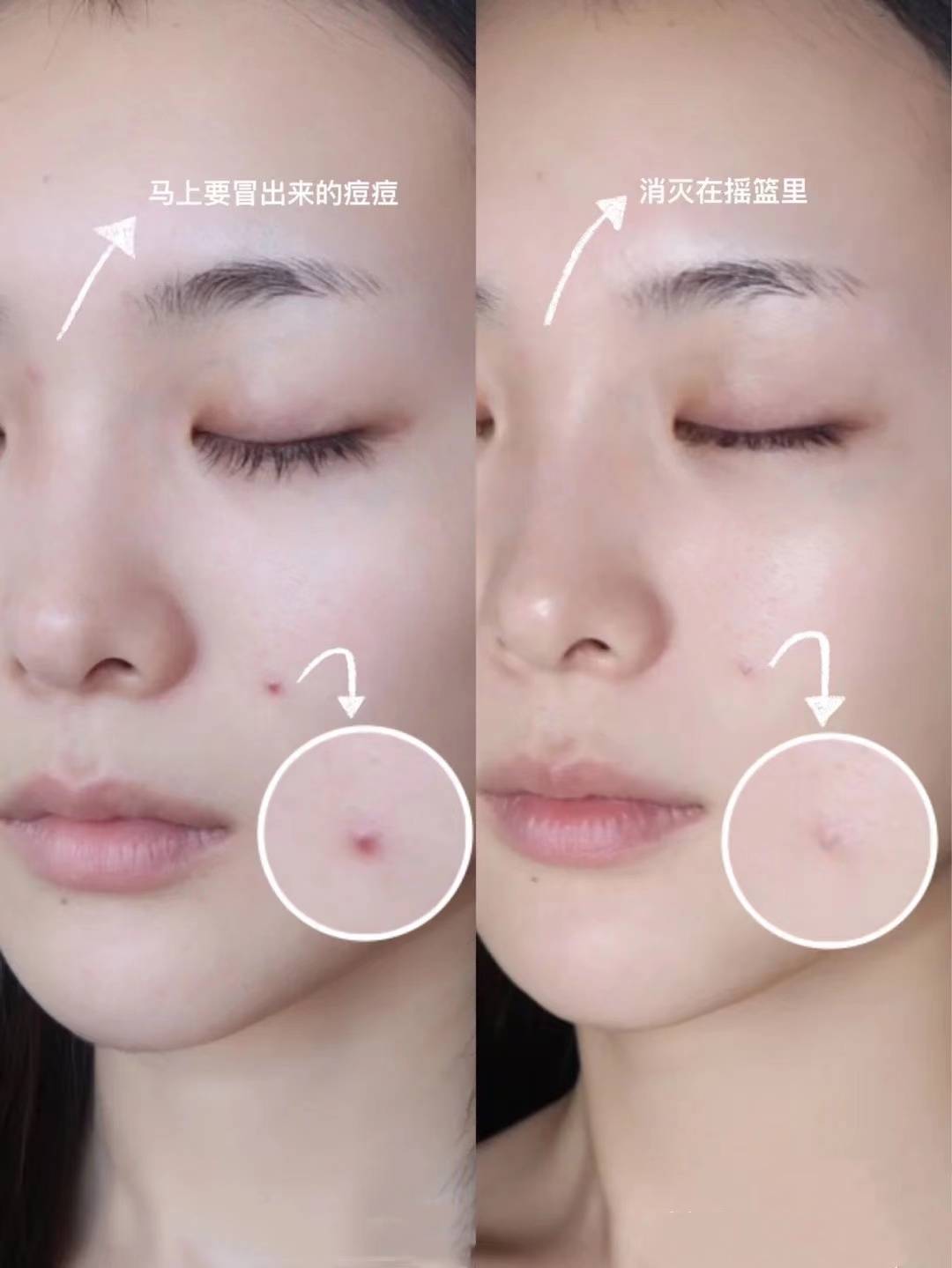 脸部卸妆棉可以用来湿敷脸吗？