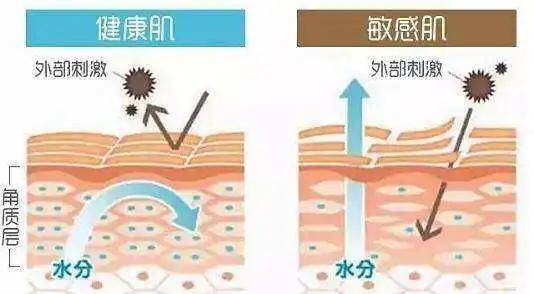 止损春敏不是病，但敏感起来挺要命！