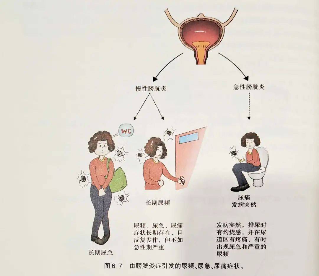 膀胱炎是什么引起的图片