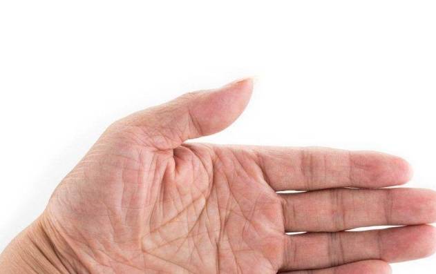 肝脏|谁说“肝癌”不痛不痒？手上的6个变化，可能是肝在向你“呼救”