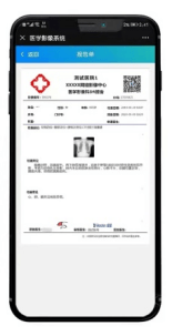 病历条形码,检查报告二维码,通过扫码一体机查看患者完整的影像数据