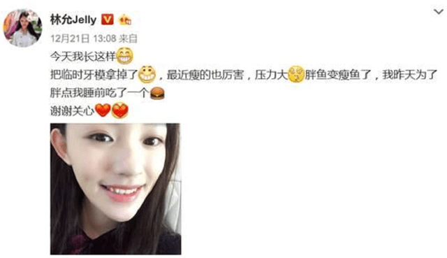 脸部明星整牙后遗症：杨幂脸部松弛，王嘉尔颧骨外扩，宋祖儿法令纹深
