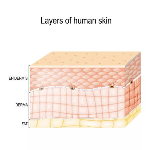 烧伤皮肤分层结构图图片