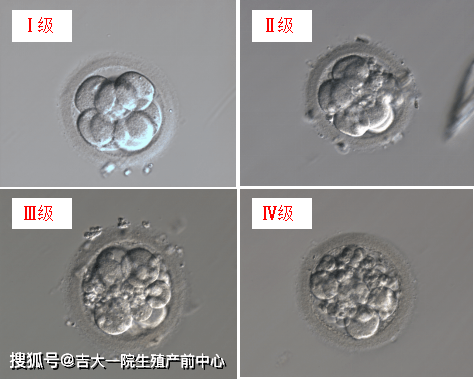 胚胎|胚胎能看出来男女吗？