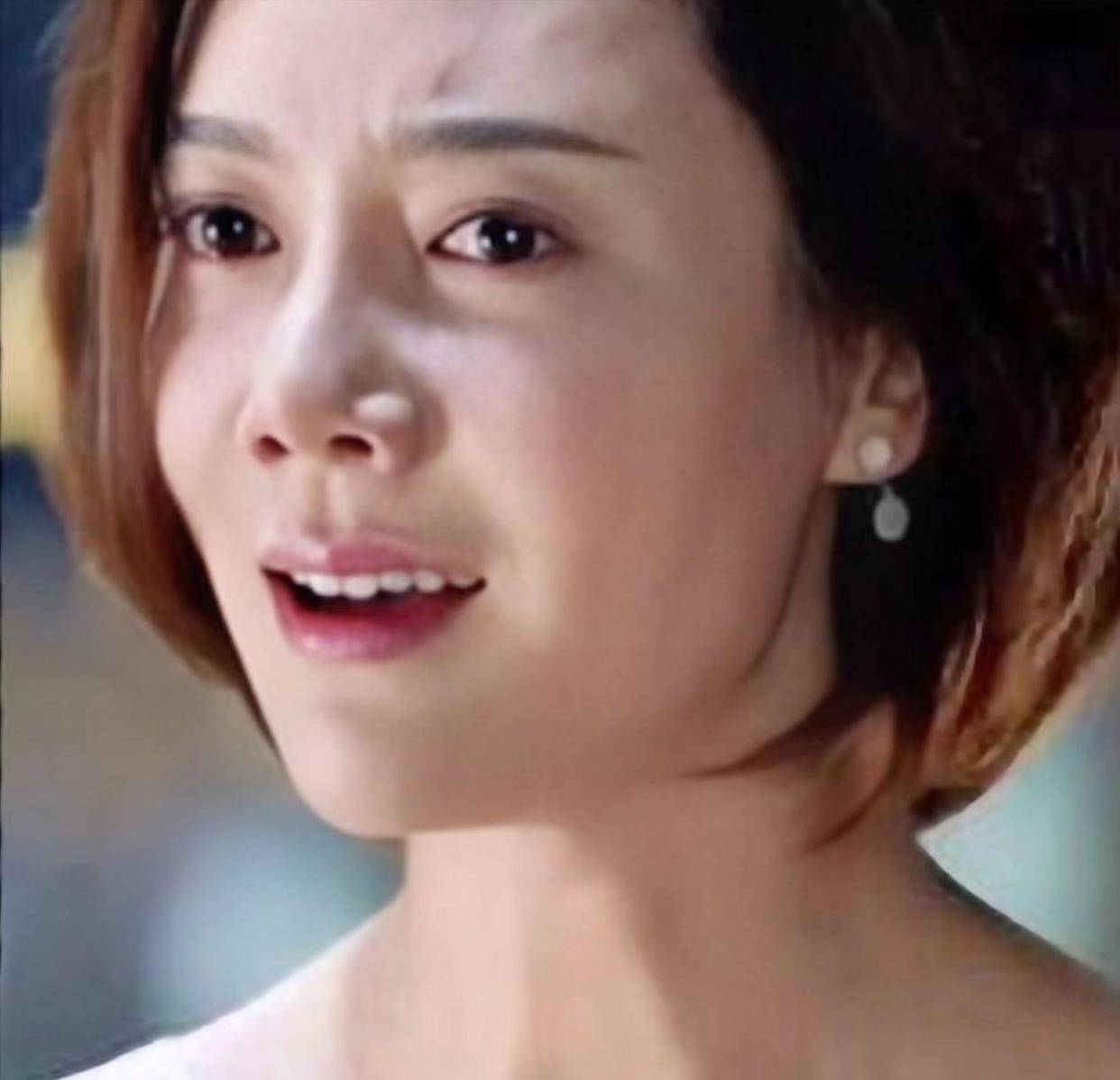 后遗症女明星为了变美，乱整鼻子留下的后遗症，至今悔恨终身