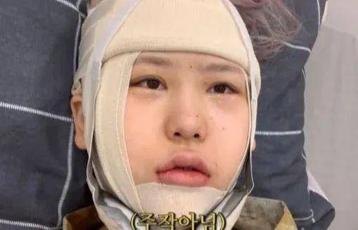 别墅19岁女孩数次整容后判若两人，称在整容上花的钱可以买套别墅