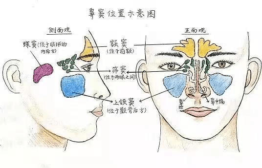 四医院|孩子反复咳嗽、鼻塞、流脓性鼻涕，以为是“感冒”？ 这都是鼻窦炎惹的祸！