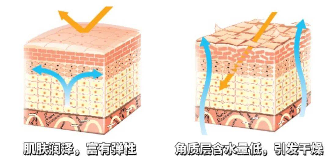 面部春季不补水，一年老十岁