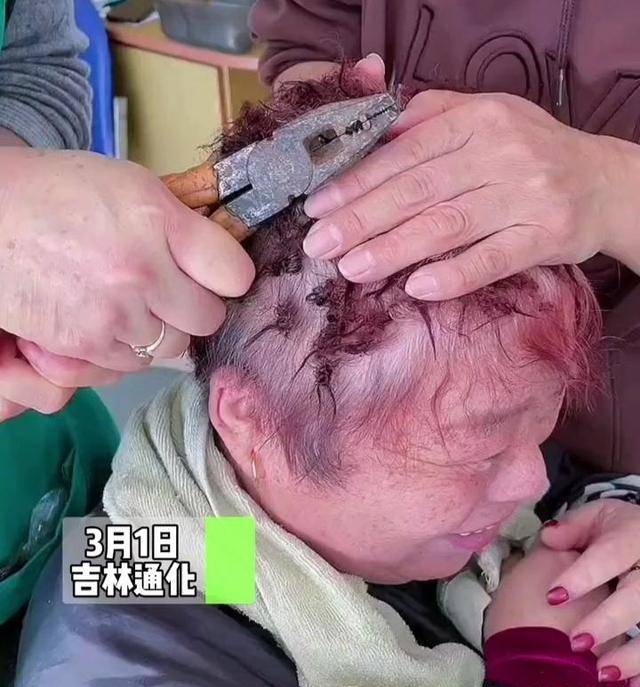 发型大妈嫌头发稀少去烫发，结果用钳子才取下卡子，大妈疼得龇牙咧嘴