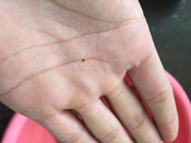 四川白天都疯狂咬人的默蚊子到底什么昆虫为何比蚊子更狠