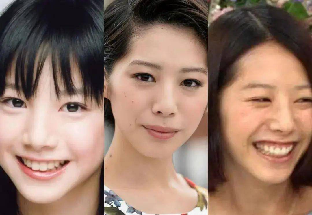 小天关晓彤是不是do脸了？凹脸变得幼态又平整