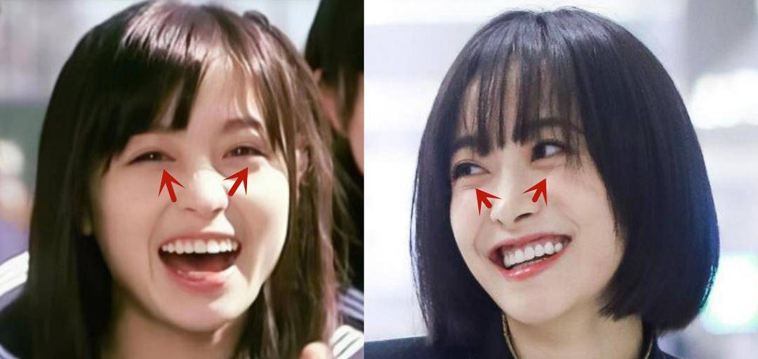 小天关晓彤是不是do脸了？凹脸变得幼态又平整