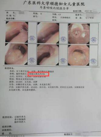 孩子腺樣體肥大達90不想做手術怎麼辦