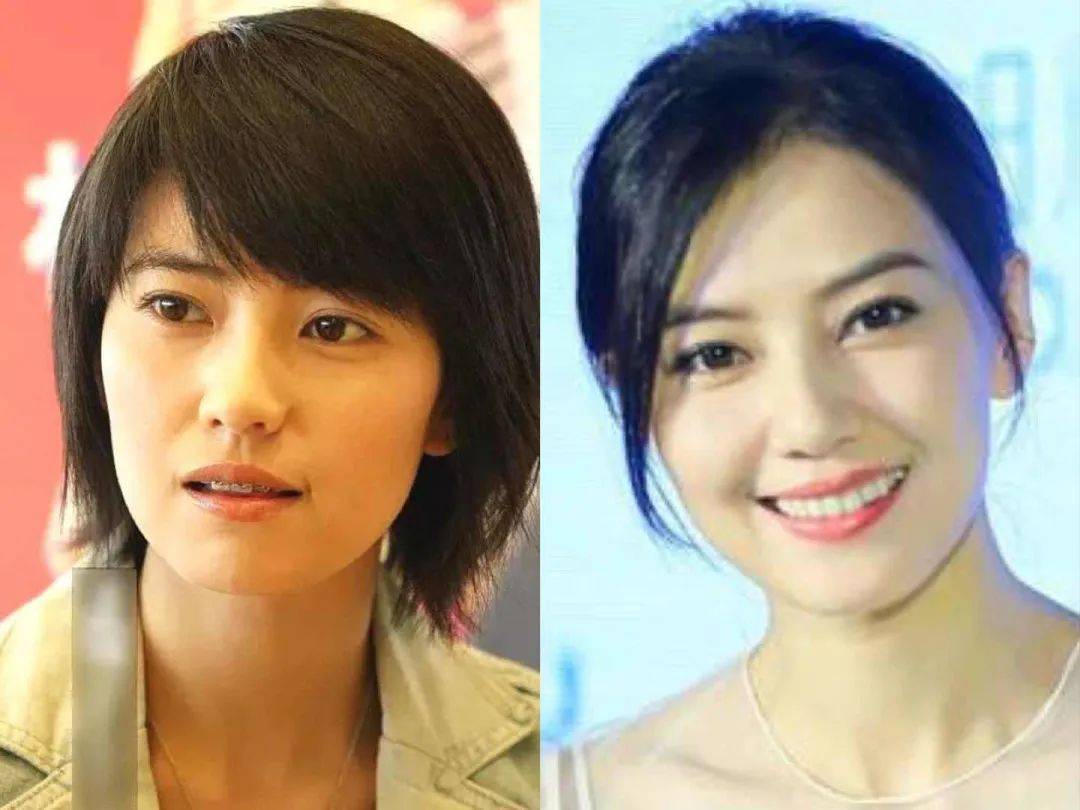 牙龈关晓彤是不是do脸了？凹脸变得幼态又平整！