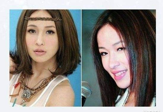 单眼皮内娱最假双眼皮PK，就差割到脑门了，生怕别人看不出是割的？