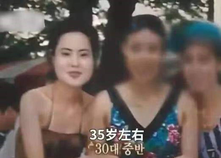 因为女星韩慧景：为了更漂亮，给脸注射食用油，把脸整成“猪头”