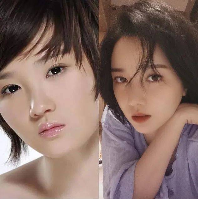 下巴5位“换头”成功付出代价的明星，鞠婧祎满脸硬伤，杨幂总是脸垮