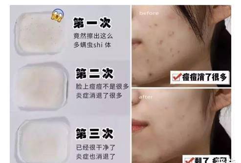 仁和北大医学博士：答应我，不要再买这些含“剧”的化妆品了！