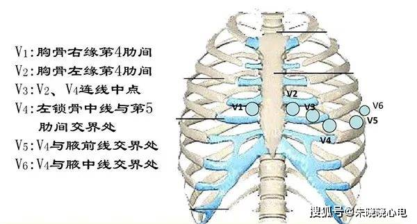 心電圖講解心電圖怎麼看