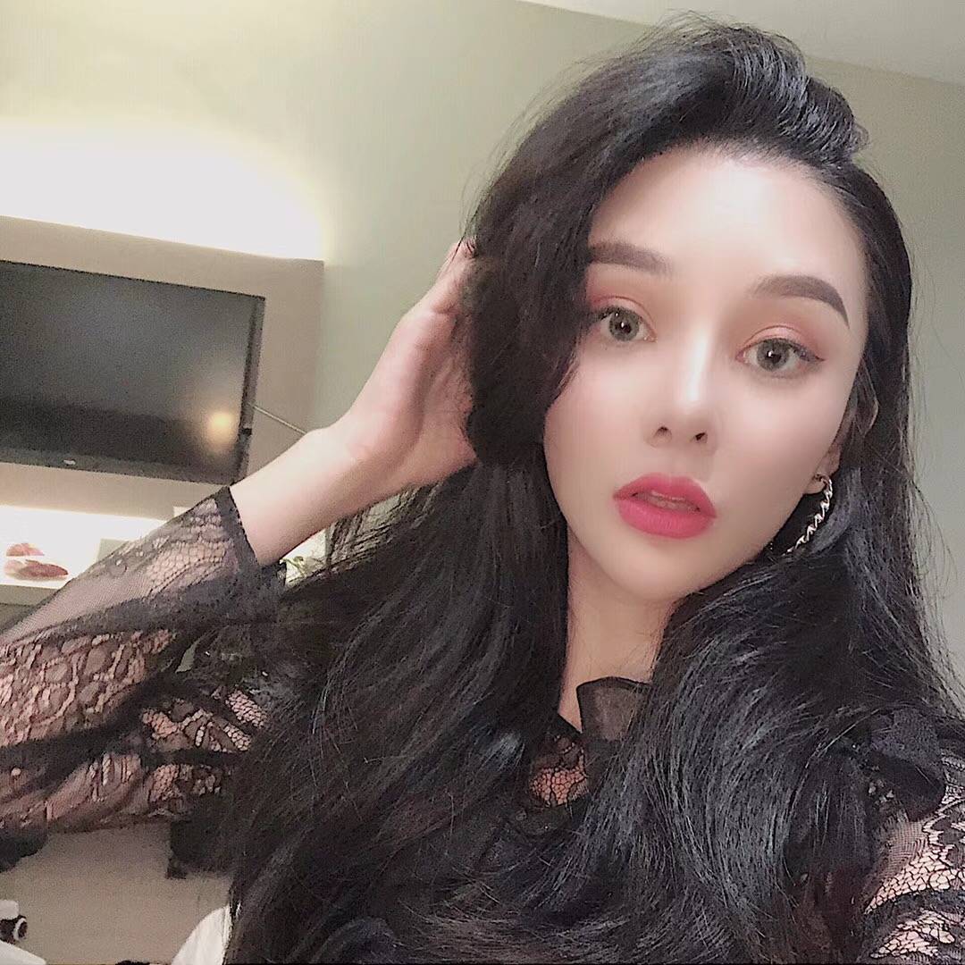 鱼尾纹王女士：面部提升术后100天的转变，用亲身经历为你解答疑惑