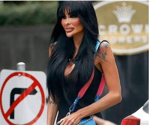 澳洲澳洲女护士120万整容,自称“限量版芭比娃娃”,奇异外表惹争议