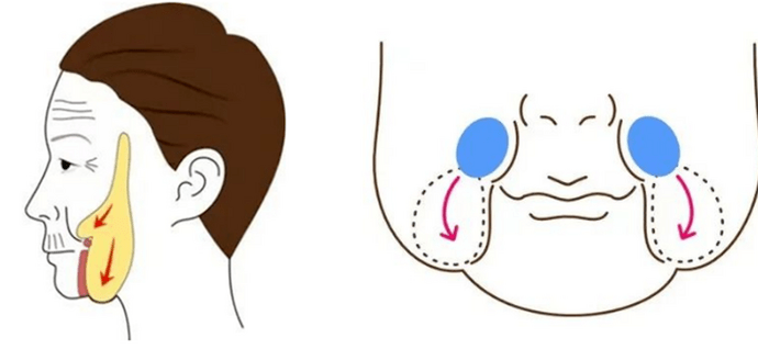 頸闊肌下脂肪墊的老化下墜是產生雙下巴頦的重要因素.