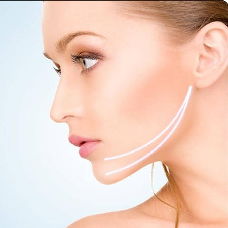 进行埋线多久才能完全恢复自然、做完变身女主的我有话说