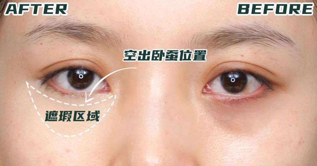 斑点妆后黑眼圈、痘痘斑点、红血丝……堪比磨皮的遮瑕攻略来了