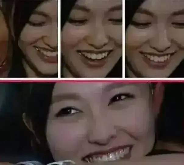 脸部明星整牙后遗症：杨幂脸部松弛，王嘉尔颧骨外扩，宋祖儿法令纹深！！
