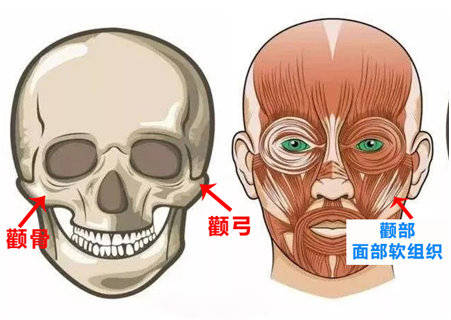 张力联合丽格何照华教授：颧骨颧弓手术采取什么固定方式