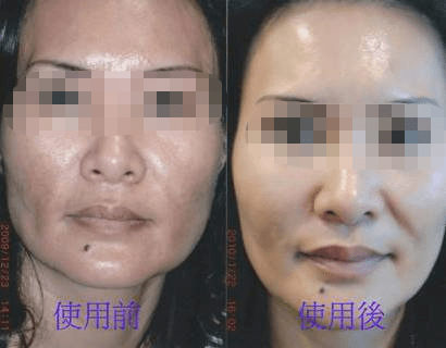什么小伙伴们、PLLA膜是什么、为什么那么多名媛是它的脑残粉～