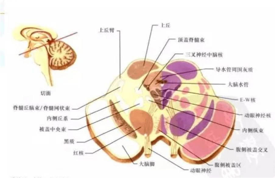 顱腦解剖入門難?這份秘籍請收好!_綜合徵_腦橋_供應