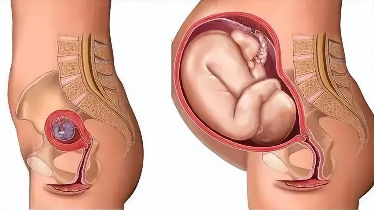 产后子宫位置恢复图图片