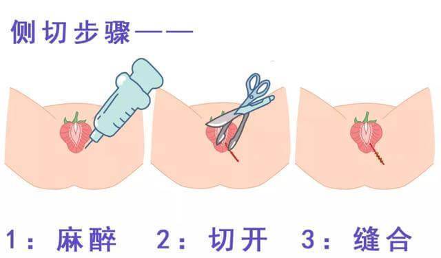 生孩子时下面被剪了一刀，会影响夫生活吗？其实很多人都误会了