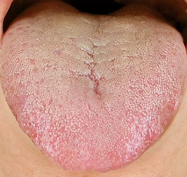 气虚是什么气虚的人怎么调理