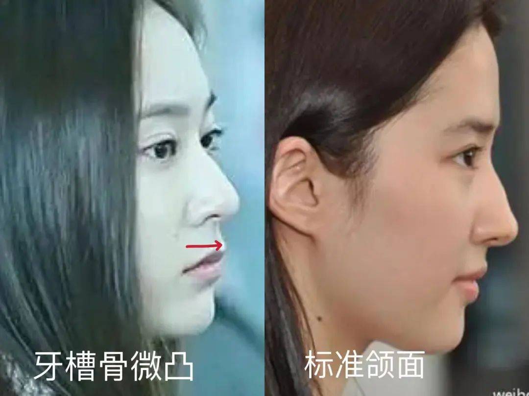 难怪都被骂!_面相_一个人_气质