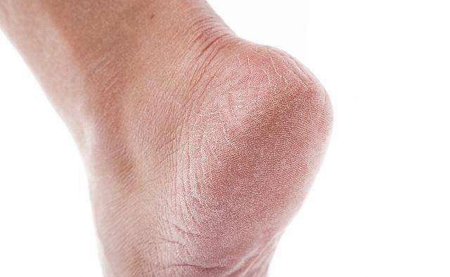 原创老年人脚后跟痛大多与这4个因素有关得好好解决了